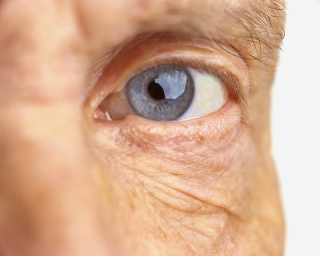 Diabetic retinopathy: Understanding diabetes-related eye disease and vision loss