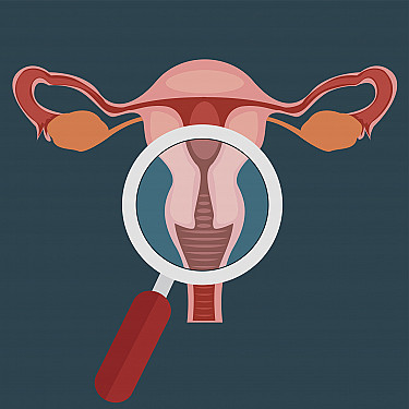 Can a daily pill lighten heavy menstrual bleeding caused by fibroids? featured image