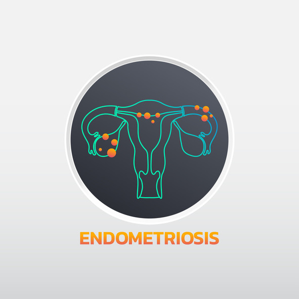 Drug Free Endometriosis, Period & Pelvic Pain Relief