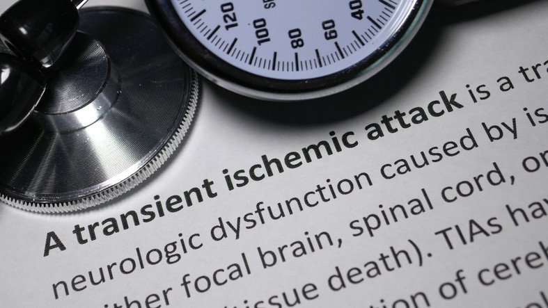 Transient ischemic attacks: Varied symptoms, all important