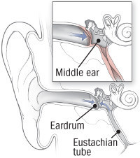 Sudden ringing and hot sale pressure in one ear