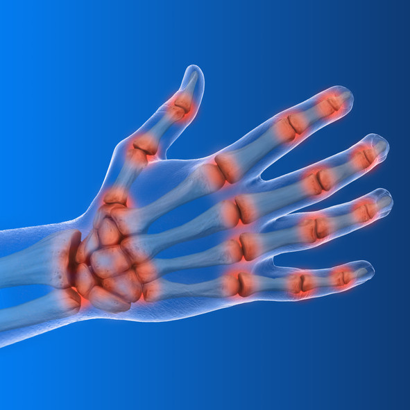 Get a helping hand for pain - Harvard Health