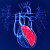 blog image 1