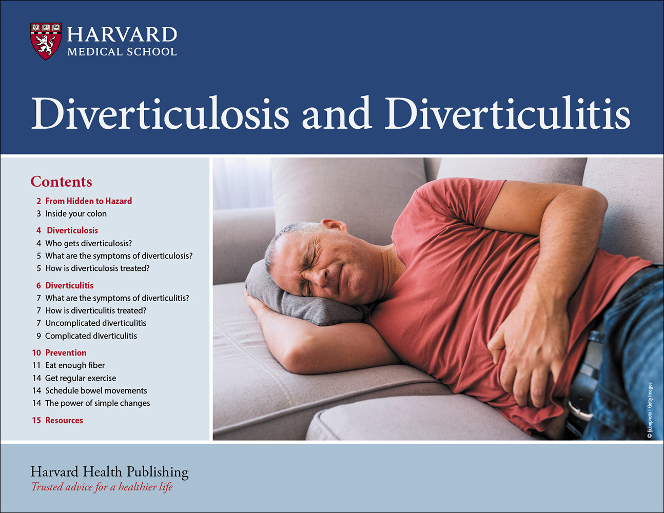 Diverticulosis and Diverticulitis