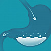blog image 1