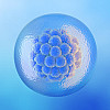 blog image 1