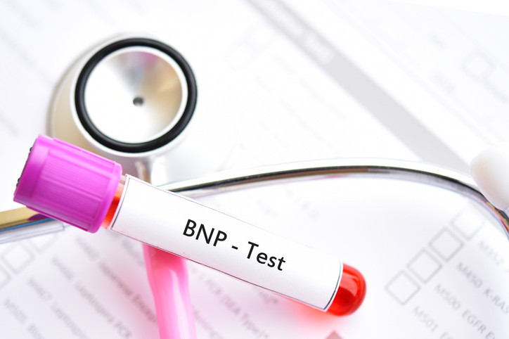 Blood sample for B-type natriuretic peptide or BNP test, cardiac marker for acute or chronic heart failure