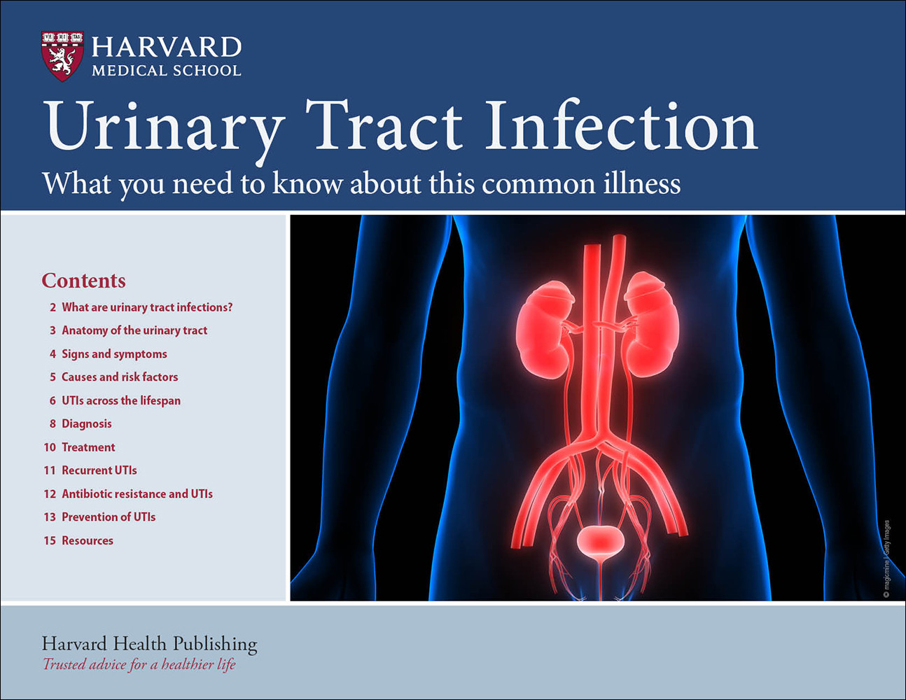 Urinary Tract Infection Harvard Health urinary-tract-infection-harvard-health