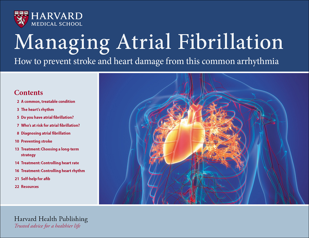Update On Atrial Fibrillation Harvard Health