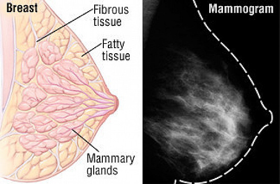 Mammography - Harvard Health