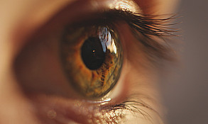 What causes cataracts? featured image