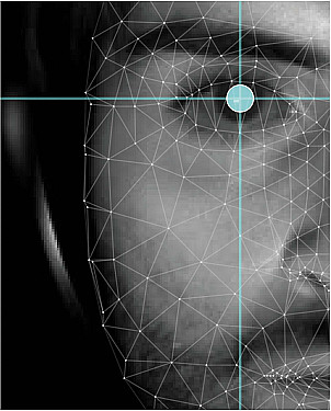 Is there finally a way to measure tinnitus? featured image