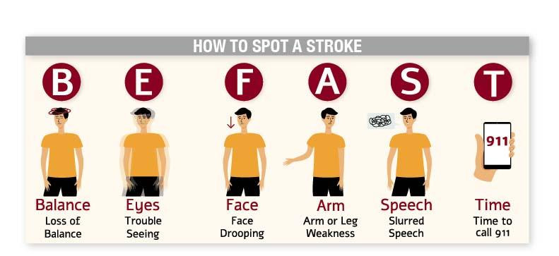 Illustration of how to spot stroke symptoms, using the BE FAST acronym.