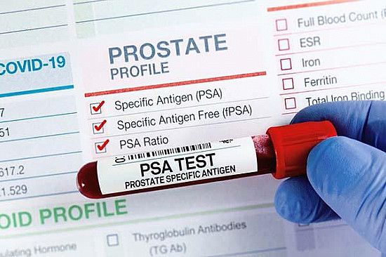 What are the symptoms of prostate cancer? featured image