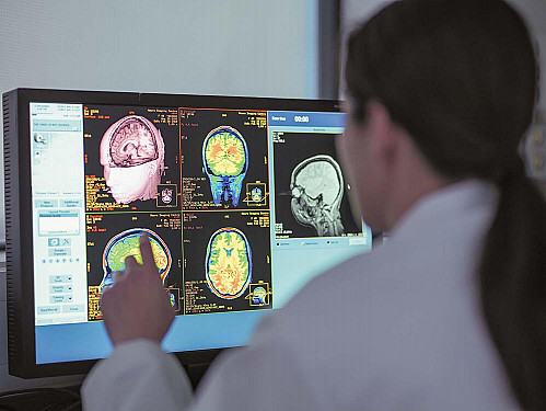 Can our brain talk to our immune system? featured image