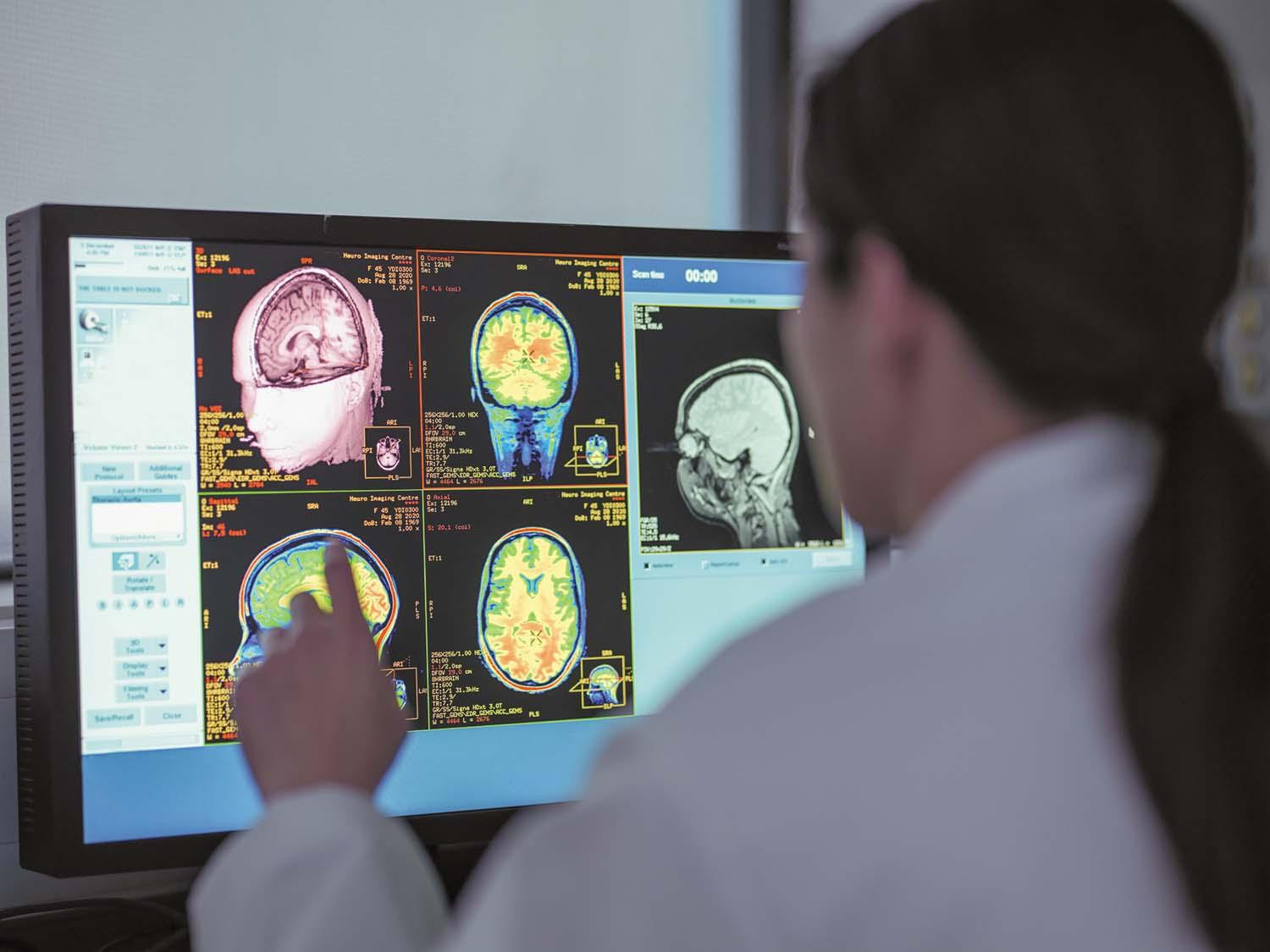 A medical technician views a monitor showing MRI scans of a person's brain, pointing at one of the images on the screen.