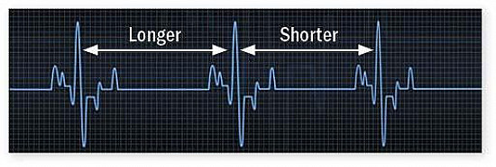 How relevant is heart rate variability? featured image