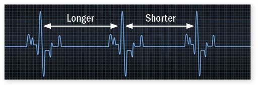 Illustration of a heart rate printout showing variations of longer and shorter lengths.