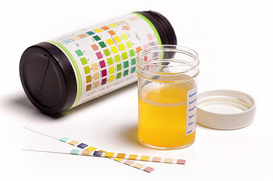 Urine and your health featured image