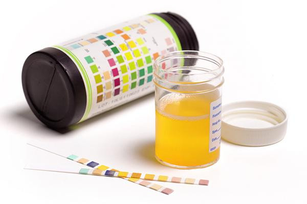 A kit for analyzing urine samples, including a collection vial with a screw-on cap, test strips, and a color-coded guide for interpreting the results.