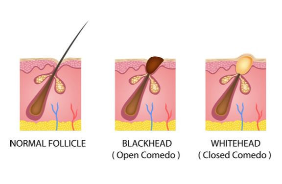 78a17060-1920-4110-8acf-2bc5cf53391c