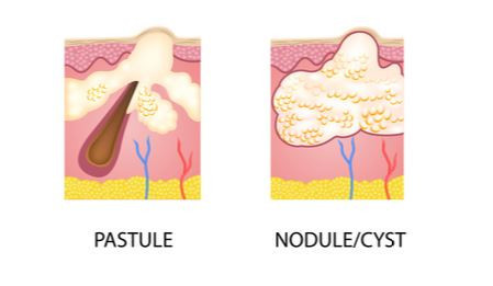 ae539d0c-a380-4a44-8bf6-4e9428202981