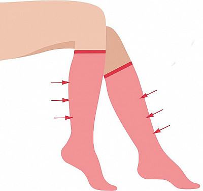 What is venous insufficiency? featured image