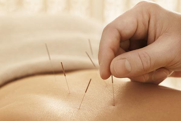Acupuncture boosts pain relief for chronic low back pain