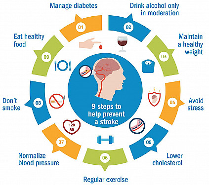 Reducing your stroke risk after a ministroke featured image