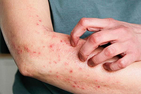 Is your skin problem actually an autoimmune condition? featured image