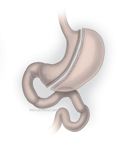 A drawing of a stomachAI-generated content may be incorrect.