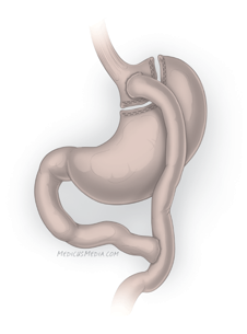 A drawing of a stomachAI-generated content may be incorrect.