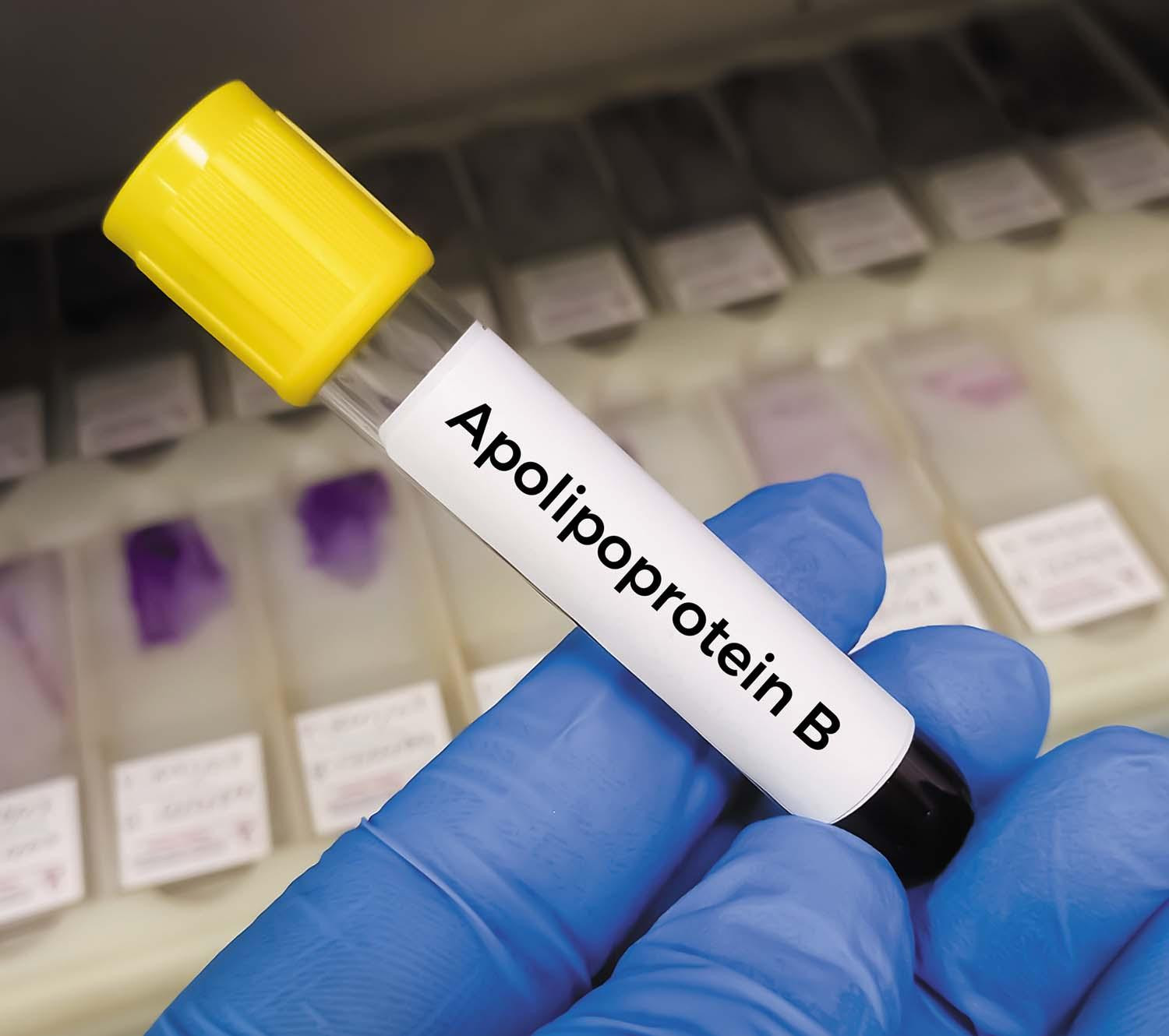 Is an apoB test a better way to check your cholesterol?