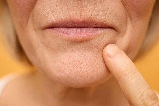 Why do my lips seem thinner than they used to be? featured image