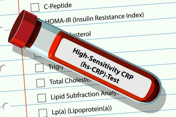 Inflammation and heart disease: A smoldering threat