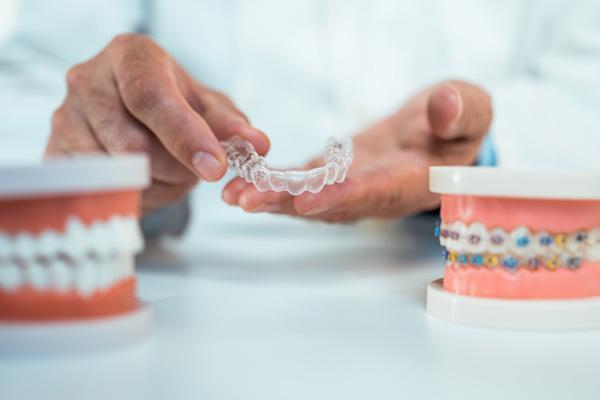 Want to prevent shifting teeth? Maybe you need retainers