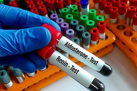 Aldosterone overload: An underappreciated contributor to high blood pressure featured image