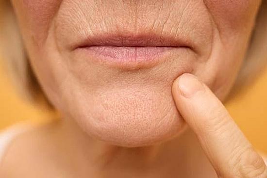 Why do my lips seem thinner than they used to be? featured image