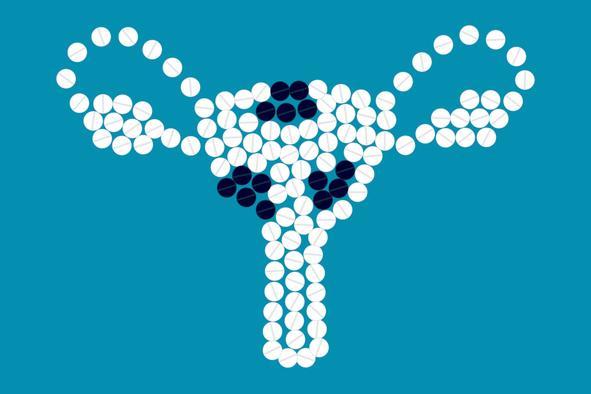 Illustration of the female reproductive system using white circular pills, with black pills indicating the presence of fibroids in the uterus.