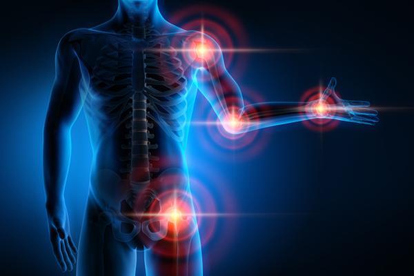 Three-dimensional illustration of a human body with visible skeleton, with areas of pain indicated in bright yellow at the shoulder, elbow, wrist, and hip.