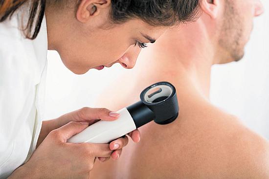 Do all skin cancers have to be removed? featured image