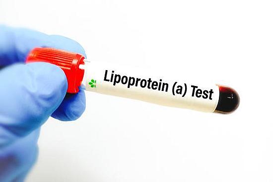 New cholesterol guidelines recommend Lp(a) blood test featured image
