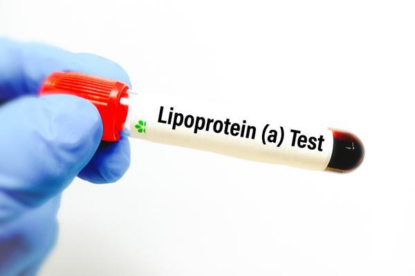 New cholesterol guidelines recommend Lp(a) blood test