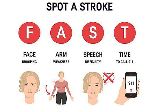 When a stroke strikes: What to expect at the emergency room featured image