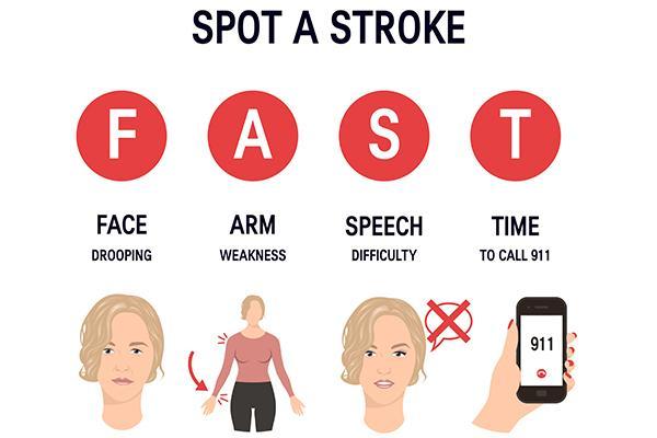 When a stroke strikes: What to expect at the emergency room