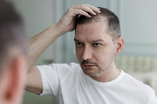 Can insufficient protein intake cause hair loss? featured image