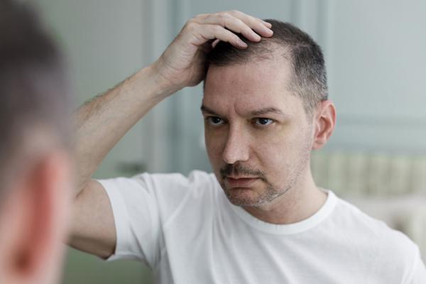 A middle-age man looks at his thinning hair in a mirror.