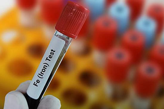 What does it mean if I have a high level of iron in my blood? featured image