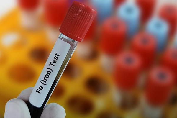 Close-up of a gloved hand holding a tube of blood that is labeled Fe (iron) test.