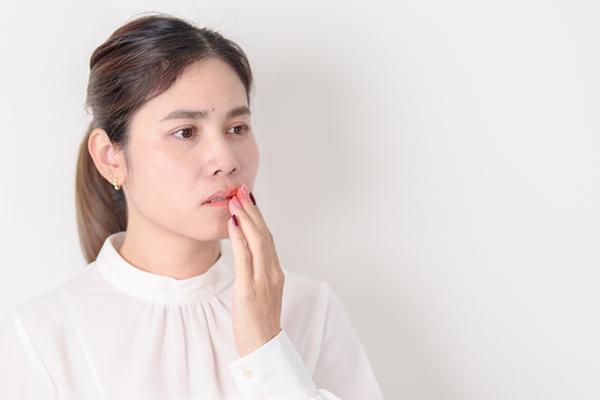 A woman experiencing oral pain holds a hand to the corner of her mouth.